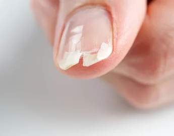 Fortalecedor de unhas: evite unhas quebradiças