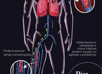 Dica do Dr. Vicente – TROMBOSE