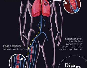 Dica do Dr. Vicente – TROMBOSE