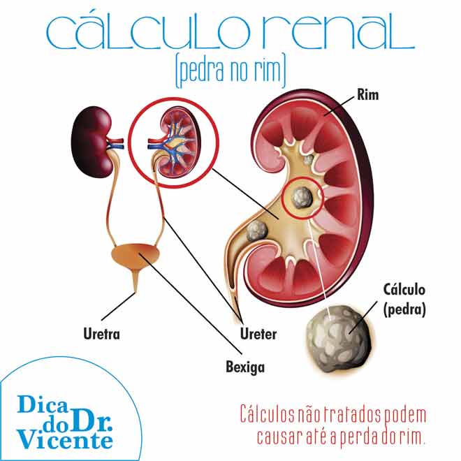 Dica do Dr. Vicente